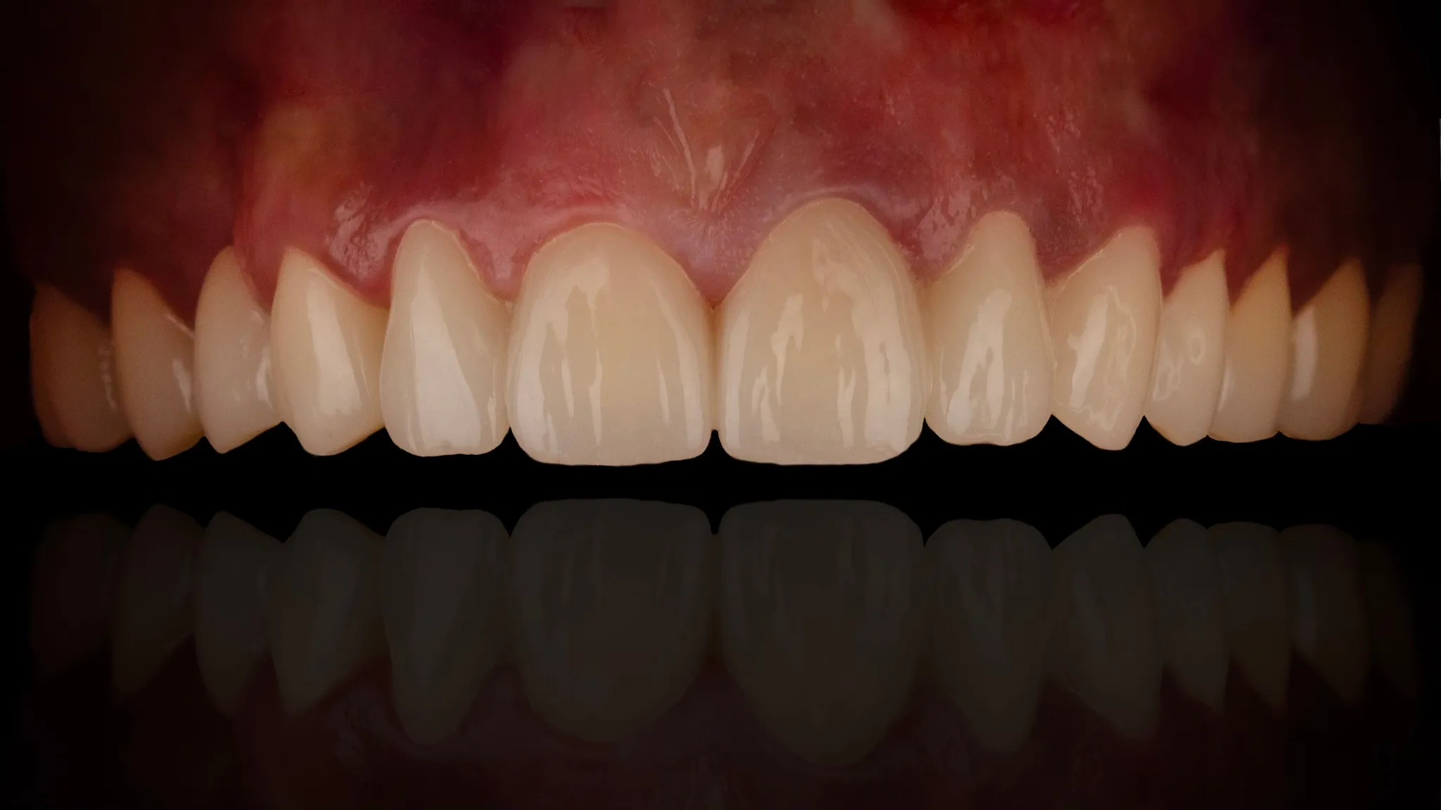 Medical photograph